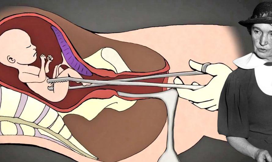Planned Parenthood – dobročinitelji ili?